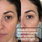 Contour de l'œil avant et après utilisation du masseur oculaire LED : cernes et poches